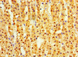Immunohistochemistry of paraffin-embedded human adrenal gland tissue using DIMT1 Antibody at dilution of 1:100Rabbit anti-Human DIMT1 Polyclonal Antibody