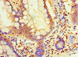 Immunohistochemistry of paraffin-embedded human small intestine tissue using DIMT1 Antibody at dilution of 1:100Rabbit anti-Human DIMT1 Polyclonal Antibody