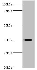 Western blot  | All lanes: DIMT1 antibody at 2μg/ml + Mouse thymus tissue  | Secondary  | Goat polyclonal to rabbit IgG at 1/10000 dilution  | Predicted band size: 35 kDa  | Observed band size: 35 kDaRabbit anti-Human DIMT1 Polyclonal Antibody
