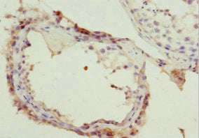 Immunohistochemistry of paraffin-embedded human testis tissue using NSFL1C Antibody at dilution of 1:100Rabbit anti-Human NSFL1C Polyclonal Antibody