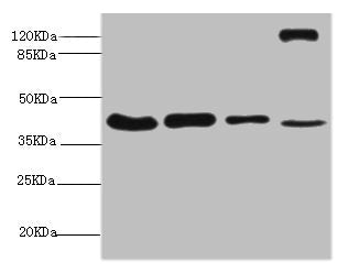Western blot | All lanes: NSFL1C antibody at 6.3μg/ml | Lane 1: Mouse brain tissue | Lane 2: A431 whole cell lysate | Lane 3: 293T whole cell lysate | Lane 4: Rat liver tissue | Secondary | Goat polyclonal to rabbit IgG at 1/10000 dilution | Predicted band size: 41, 38, 29 kDa | Observed band size: 41, 130 kDaRabbit anti-Human NSFL1C Polyclonal Antibody