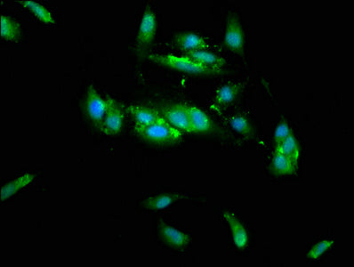Immunofluorescence staining of Hela cells with TRIM35 Antibody at 1:133, counter-stained with DAPI. The cells were fixed in 4% formaldehyde, permeabilized using 0.2% Triton X-100 and blocked in 10% normal Goat Serum. The cells were then incubated with the antibody overnight at 4°C. The secondary antibody was Alexa Fluor 488-congugated AffiniPure Goat Anti-Rabbit IgG(H+L).Rabbit anti-Human TRIM35 Polyclonal Antibody
