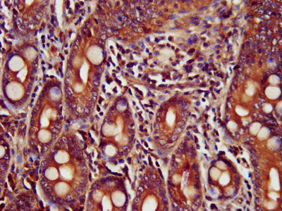 IHC image of TRIM35 Antibody diluted at 1:400 and staining in paraffin-embedded human small intestine tissue performed on a Leica BondTM system. After dewaxing and hydration, antigen retrieval was mediated by high pressure in a citrate buffer (pH 6.0). Section was blocked with 10% normal goat serum 30min at RT. Then primary antibody (1% BSA) was incubated at 4°C overnight. The primary is detected by a biotinylated secondary antibody and visualized using an HRP conjugated SP system.Rabbit anti-Human TRIM35 Polyclonal Antibody
