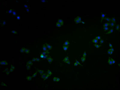 Immunofluorescence staining of Hela cells with CAMK2A Antibody at 1:100, counter-stained with DAPI. The cells were fixed in 4% formaldehyde and blocked in 10% normal Goat Serum. The cells were then incubated with the antibody overnight at 4°C. The secondary antibody was Alexa Fluor 488-congugated AffiniPure Goat Anti-Rabbit IgG(H+L).