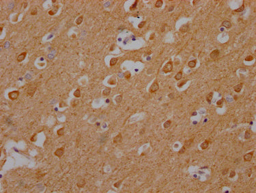 IHC image of CAMK2A Antibody diluted at 1:200 and staining in paraffin-embedded human brain tissue performed on a Leica BondTM system. After dewaxing and hydration, antigen retrieval was mediated by high pressure in a citrate buffer (pH 6.0). Section was blocked with 10% normal goat serum 30min at RT. Then primary antibody (1% BSA) was incubated at 4°C overnight. The primary is detected by a Goat anti-rabbit polymer IgG labeled by HRP and visualized using 0.05% DAB.