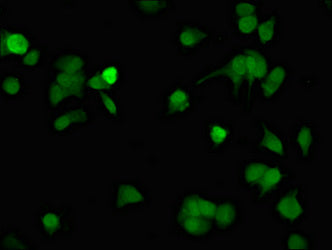 Immunofluorescent analysis of MCF-7 cells using CD207 Antibody at dilution of 1: 100 and Alexa Fluor 488-congugated AffiniPure Goat Anti-Rabbit IgG(H+L)Rabbit anti-Human CD207 Polyclonal Antibody