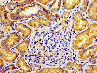 Immunohistochemistry of paraffin-embedded human kidney tissue using CD207 Antibody at dilution of 1: 100Rabbit anti-Human CD207 Polyclonal Antibody