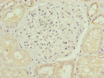 Immunohistochemistry of paraffin-embedded human kidney tissue using MID2 Antibody at dilution of 1:100