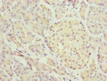 Immunohistochemistry of paraffin-embedded human pancreatic tissue using MID2 Antibody at dilution of 1:100