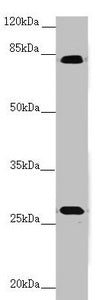 Western blot | All lanes: MID2 antibody at 3.32 μg/ml + Mouse small intestine tissue | Secondary | Goat polyclonal to rabbit IgG at 1/10000 dilution | Predicted band size: 84, 80 kDa | Observed band size: 84, 30 kDa