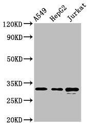Western Blot  | Positive WB detected in: A549 whole cell lysate, HepG2 whole cell lysate, Jurkat whole cell lysate  | All lanes: RALY antibody at 5.7µg/ml  | Secondary  | Goat polyclonal to rabbit IgG at 1/50000 dilution  | Predicted band size: 33, 31 kDa  | Observed band size: 33 kDaRabbit anti-Human RALY Polyclonal Antibody