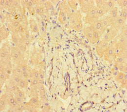 Immunohistochemistry of paraffin-embedded human liver tissue using PPM1H Antibody at dilution of 1:100Rabbit anti-Human PPM1H Polyclonal Antibody