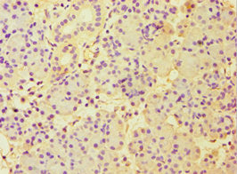 Immunohistochemistry of paraffin-embedded human pancreatic tissue using CBLC Antibody at dilution of 1:100