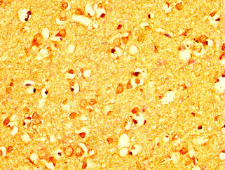 IHC image of RAB26 Antibody diluted at 1:200 and staining in paraffin-embedded human brain tissue performed on a Leica BondTM system. After dewaxing and hydration, antigen retrieval was mediated by high pressure in a citrate buffer (pH 6.0). Section was blocked with 10% normal goat serum 30min at RT. Then primary antibody (1% BSA) was incubated at 4°C overnight. The primary is detected by a biotinylated secondary antibody and visualized using an HRP conjugated SP system.Rabbit anti-Human RAB26 Polyclonal Antibody