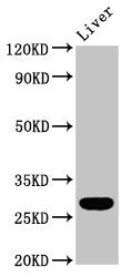 Western Blot | Positive WB detected in: Rat liver tissue | All lanes: RAB26 antibody at 5.9μg/ml | Secondary | Goat polyclonal to rabbit IgG at 1/50000 dilution | Predicted band size: 28, 22 kDa | Observed band size: 28 kDaRabbit anti-Human RAB26 Polyclonal Antibody