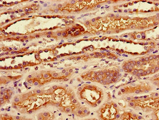 Immunohistochemistry of paraffin-embedded human kidney tissue using SLC7A7 Antibody at dilution of 1:100Rabbit anti-Human SLC7A7 Polyclonal Antibody