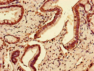 Immunohistochemistry of paraffin-embedded human pancreatic tissue using SLC7A7 Antibody at dilution of 1:100Rabbit anti-Human SLC7A7 Polyclonal Antibody