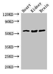 Western Blot | Positive WB detected in: Mouse heart tissue, Mouse kidney tissue, Mouse brain tissue | All lanes: SLC7A7 antibody at 3.5μg/ml | Secondary | Goat polyclonal to rabbit IgG at 1/50000 dilution | Predicted band size: 56 kDa | Observed band size: 56 kDaRabbit anti-Human SLC7A7 Polyclonal Antibody