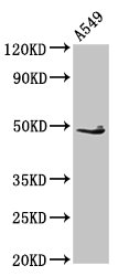 Western Blot  | Positive WB detected in: A549 whole cell lysate  | All lanes: EDAR antibody at 2.7µg/ml  | Secondary  | Goat polyclonal to rabbit IgG at 1/50000 dilution  | Predicted band size: 49, 52 kDa  | Observed band size: 49 kDaRabbit anti-Human EDAR Polyclonal Antibody