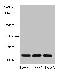 Western blot | All lanes: SSR3 antibody at 10μg/ml | Lane 1: Hela whole cell lysate | Lane 2: U87 whole cell lysate | Lane 3: A431 whole cell lysate | Secondary | Goat polyclonal to rabbit IgG at 1/10000 dilution | Predicted band size: 22, 23 kDa | Observed band size: 22 kDaRabbit anti-Human SSR3 Polyclonal Antibody