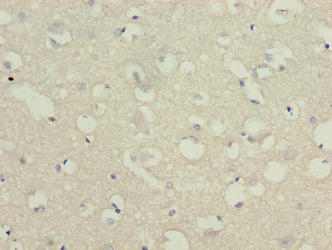 Immunohistochemistry of paraffin-embedded human brain tissue using C3orf18 Antibody at dilution of 1:100
