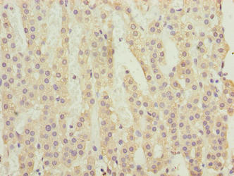 Immunohistochemistry of paraffin-embedded human adrenal gland tissue using C3orf18 Antibody at dilution of 1:100
