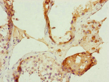 Immunohistochemistry of paraffin-embedded human testis tissue using FBXL5 Antibody at dilution of 1:100Rabbit anti-Human FBXL5 Polyclonal Antibody