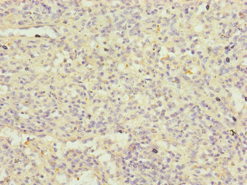 Immunohistochemistry of paraffin-embedded human spleen tissue using FBXL5 Antibody at dilution of 1:100Rabbit anti-Human FBXL5 Polyclonal Antibody