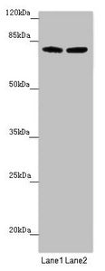 Western blot | All lanes: FBXL5 antibody at 1.51 μg/ml | Lane 1: Mouse lung tissue | Lane 2: Mouse gonadal tissue | Secondary | Goat polyclonal to rabbit IgG at 1/10000 dilution | Predicted band size: 79, 77 kDa | Observed band size: 79, 95 kDaRabbit anti-Human FBXL5 Polyclonal Antibody