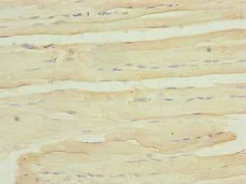 Immunohistochemistry of paraffin-embedded human skeletal muscle tissue using MYO5B Antibody at dilution of 1:100Rabbit anti-Human MYO5B Polyclonal Antibody