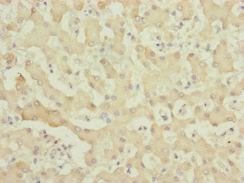 Immunohistochemistry of paraffin-embedded human liver tissue using MYO5B Antibody at dilution of 1:100Rabbit anti-Human MYO5B Polyclonal Antibody