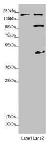 Western blot  | All lanes: MYO5B antibody at 1.7µg/ml  | Lane 1: Jurkat whole cell lysate  | Lane 2: HepG2 whole cell lysate  | Secondary  | Goat polyclonal to rabbit IgG at 1/10000 dilution  | Predicted band size: 214, 112, 48 kDa  | Observed band size: 214, 112, 48 kDaRabbit anti-Human MYO5B Polyclonal Antibody