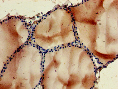 Immunohistochemistry of paraffin-embedded human thyroid tissue using NOB1 Antibody at dilution of 1:100Rabbit anti-Human NOB1 Polyclonal Antibody