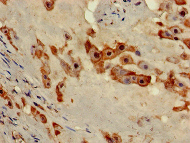 Immunohistochemistry of paraffin-embedded human placenta tissue using NOB1 Antibody at dilution of 1:100Rabbit anti-Human NOB1 Polyclonal Antibody