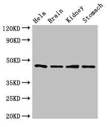 Western Blot | Positive WB detected in: Hela whole cell lysate, Mouse brain tissue, Mouse kidney tissue, Mouse stomach tissue | All lanes: NOB1 antibody at 1.5μg/ml | Secondary | Goat polyclonal to rabbit IgG at 1/50000 dilution | Predicted band size: 47 kDa | Observed band size: 47 kDaRabbit anti-Human NOB1 Polyclonal Antibody