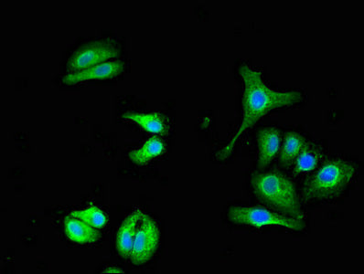 Immunofluorescent analysis of HepG2 cells using UBQLN1 Antibody at dilution of 1:100 and Alexa Fluor 488-congugated AffiniPure Goat Anti-Rabbit IgG(H+L)Rabbit anti-Human UBQLN1 Polyclonal Antibody