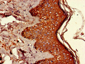 Immunohistochemistry of paraffin-embedded human skin tissue using UBQLN1 Antibody at dilution of 1:100Rabbit anti-Human UBQLN1 Polyclonal Antibody