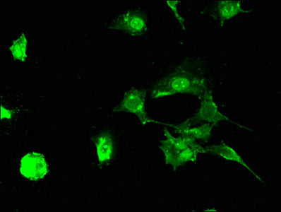 Immunofluorescent analysis of MCF-7 cells using STUB1 Antibody at dilution of 1:100 and Alexa Fluor 488-congugated AffiniPure Goat Anti-Rabbit IgG(H+L)Rabbit anti-Human STUB1 Polyclonal Antibody