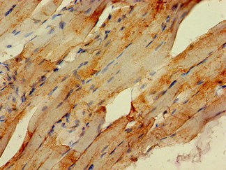 Immunohistochemistry of paraffin-embedded human skeletal muscle tissue using STUB1 Antibody at dilution of 1:100Rabbit anti-Human STUB1 Polyclonal Antibody