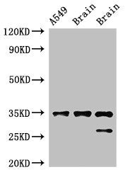Western Blot | Positive WB detected in: A549 whole cell lysate, Rat brain tissue, Mouse brain tissue | All lanes: STUB1 antibody at 2μg/ml | Secondary | Goat polyclonal to rabbit IgG at 1/50000 dilution | Predicted band size: 35, 28 kDa | Observed band size: 35, 28 kDaRabbit anti-Human STUB1 Polyclonal Antibody