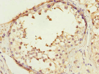 Immunohistochemistry of paraffin-embedded human testis tissue using COPS3 Antibody at dilution of 1:100Rabbit anti-Human COPS3 Polyclonal Antibody