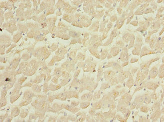 Immunohistochemistry of paraffin-embedded human heart tissue using COPS3 Antibody at dilution of 1:100Rabbit anti-Human COPS3 Polyclonal Antibody