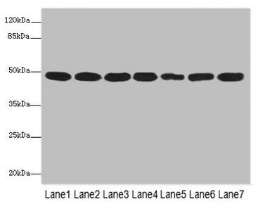 Western blot  | All lanes: COPS3 antibody at 3.41µg/ml  | Lane 1: MCF-7 whole cell lysate  | Lane 2: Hela whole cell lysate  | Lane 3: 293T whole cell lysate  | Lane 4: HT29 whole cell lysate  | Lane 5: Mouse heart tissue  | Lane 6: Mouse brain tissue  | Lane 7: Mouse ovarian tissue  | Secondary  | Goat polyclonal to rabbit IgG at 1/10000 dilution  | Predicted band size: 48, 46 kDa  | Observed band size: 48 kDaRabbit anti-Human COPS3 Polyclonal Antibody