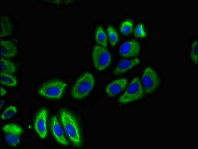 Immunofluorescent analysis of A549 cells using SLC12A7 Antibody at dilution of 1:100 and Alexa Fluor 488-congugated AffiniPure Goat Anti-Rabbit IgG(H+L)Rabbit anti-Human SLC12A7 Polyclonal Antibody