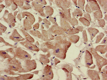 Immunohistochemistry of paraffin-embedded human heart tissue using SLC12A7 Antibody at dilution of 1:100Rabbit anti-Human SLC12A7 Polyclonal Antibody