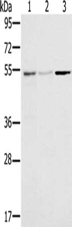Gel: 8%SDS-PAGE, Lysate: 40 μg, Lane 1-3: Human placenta tissue, huvec cells, mouse brain tissue, Primary antibody: SLC39A7 Antibody(SLC39A7 Antibody) at dilution 1/200, Secondary antibody: Goat anti rabbit IgG at 1/8000 dilution, Exposure time: 30 secondsRabbit anti-Human SLC39A7 Polyclonal Antibody