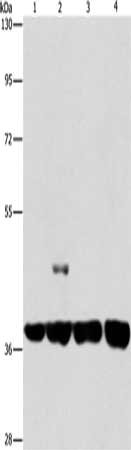 Gel: 8%SDS-PAGE, Lysate: 40 μg, Lane 1-4: 293T cells, 231 cells, U937 cells, Raji cells, Primary antibody: SERPINA9 Antibody(SERPINA9 Antibody) at dilution 1/350, Secondary antibody: Goat anti rabbit IgG at 1/8000 dilution, Exposure time: 10 secondsRabbit anti-Human SERPINA9 Polyclonal Antibody