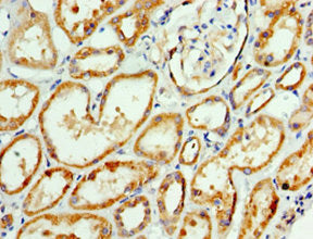 Immunohistochemistry of paraffin-embedded human kidney tissue using AP1M2 Antibody at dilution of 1:100Rabbit anti-Human AP1M2 Polyclonal Antibody