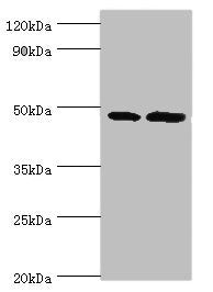 Western blot | All lanes: AP1M2 antibody at 2μg/ml | Lane 1: Mouse small intestine tissue | Lane 2: Mouse kidney tisueSecondary | Goat polyclonal to rabbit IgG at 1/10000 dilution | Predicted band size: 48 kDa | Observed band size: 48 kDaRabbit anti-Human AP1M2 Polyclonal Antibody