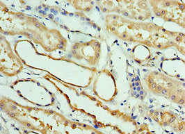 Immunohistochemistry of paraffin-embedded human kidney tissue using the antibody at dilution of 1:100Rabbit anti-Human CLEC11A Polyclonal Antibody